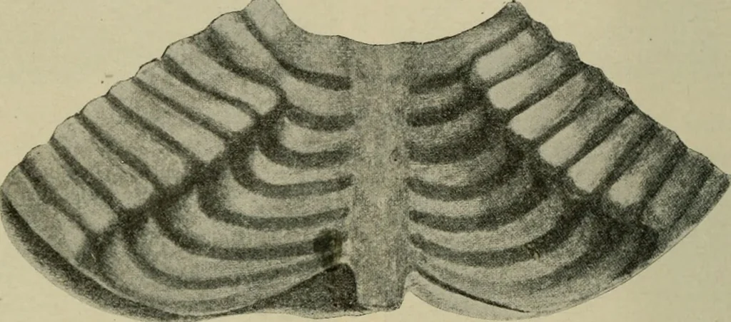 An illustration from Diseases of infancy and childhood, their dietetic, hygienic, and medical treatment : a text-book designed for practitioners and students in medicine / By Louis Fischer., 1910, leaf 402