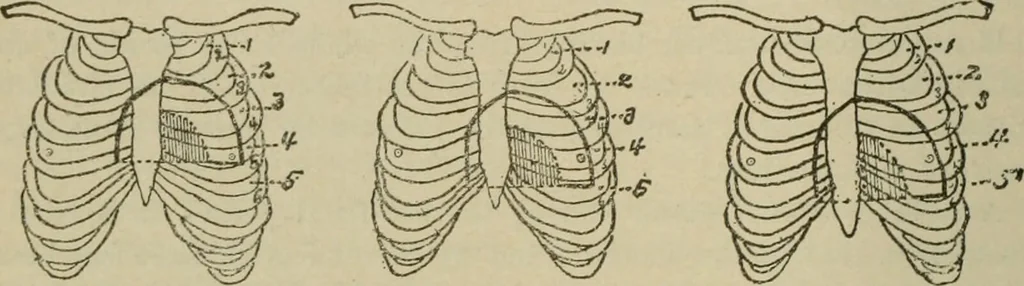 An illustration from Diseases of infancy and childhood, their dietetic, hygienic, and medical treatment : a text-book designed for practitioners and students in medicine / By Louis Fischer., 1910, leaf 418