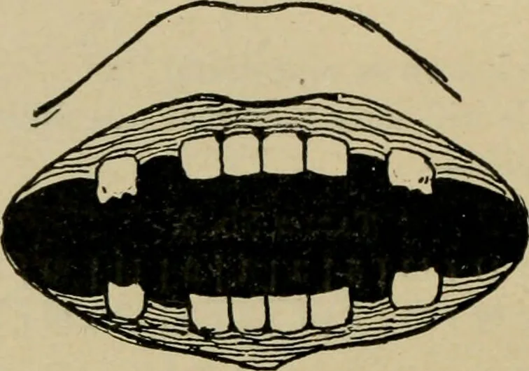 An illustration from Diseases of infancy and childhood, their dietetic, hygienic, and medical treatment : a text-book designed for practitioners and students in medicine / By Louis Fischer., 1910, leaf 42
