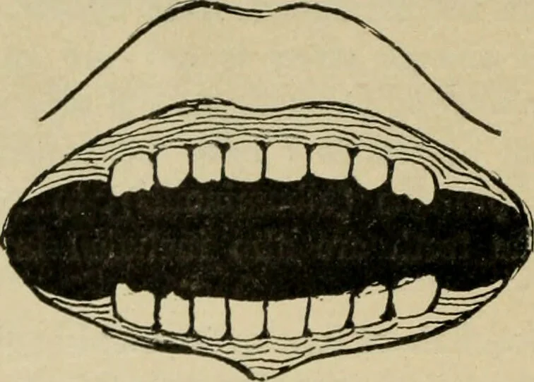 An illustration from Diseases of infancy and childhood, their dietetic, hygienic, and medical treatment : a text-book designed for practitioners and students in medicine / By Louis Fischer., 1910, leaf 42