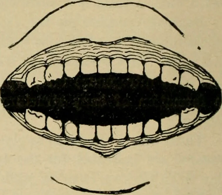 An illustration from Diseases of infancy and childhood, their dietetic, hygienic, and medical treatment : a text-book designed for practitioners and students in medicine / By Louis Fischer., 1910, leaf 42