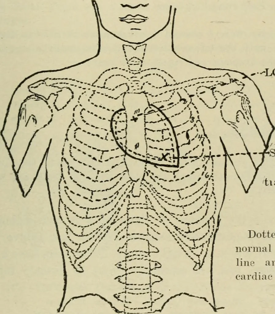 An illustration from Diseases of infancy and childhood, their dietetic, hygienic, and medical treatment : a text-book designed for practitioners and students in medicine / By Louis Fischer., 1910, leaf 425