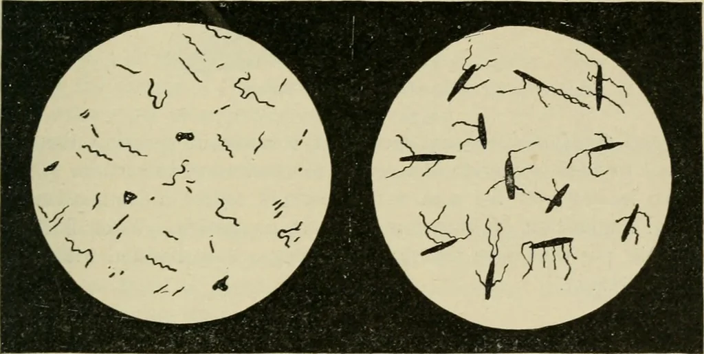 An illustration from Diseases of infancy and childhood, their dietetic, hygienic, and medical treatment : a text-book designed for practitioners and students in medicine / By Louis Fischer., 1910, leaf 489