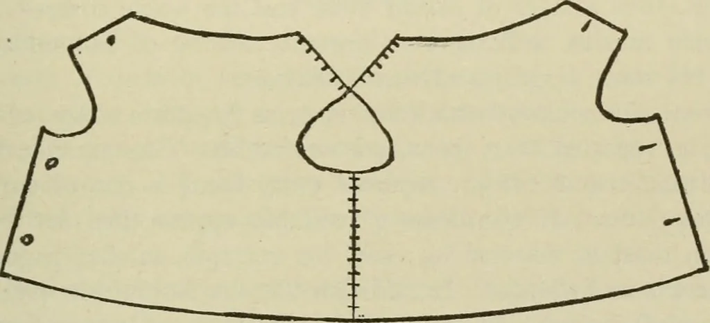 An illustration from Diseases of infancy and childhood, their dietetic, hygienic, and medical treatment : a text-book designed for practitioners and students in medicine / By Louis Fischer., 1910, leaf 519