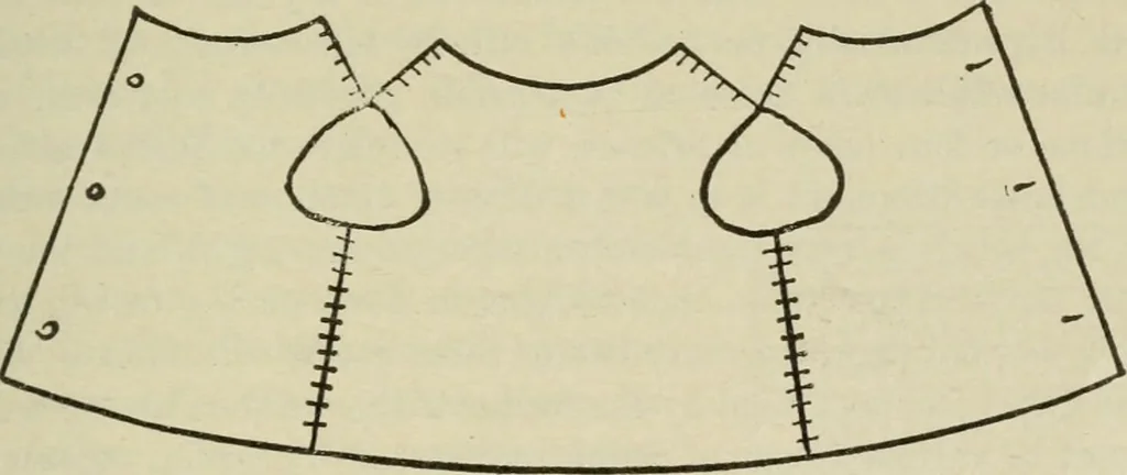 An illustration from Diseases of infancy and childhood, their dietetic, hygienic, and medical treatment : a text-book designed for practitioners and students in medicine / By Louis Fischer., 1910, leaf 519