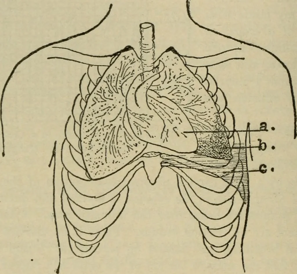 An illustration from Diseases of infancy and childhood, their dietetic, hygienic, and medical treatment : a text-book designed for practitioners and students in medicine / By Louis Fischer., 1910, leaf 524