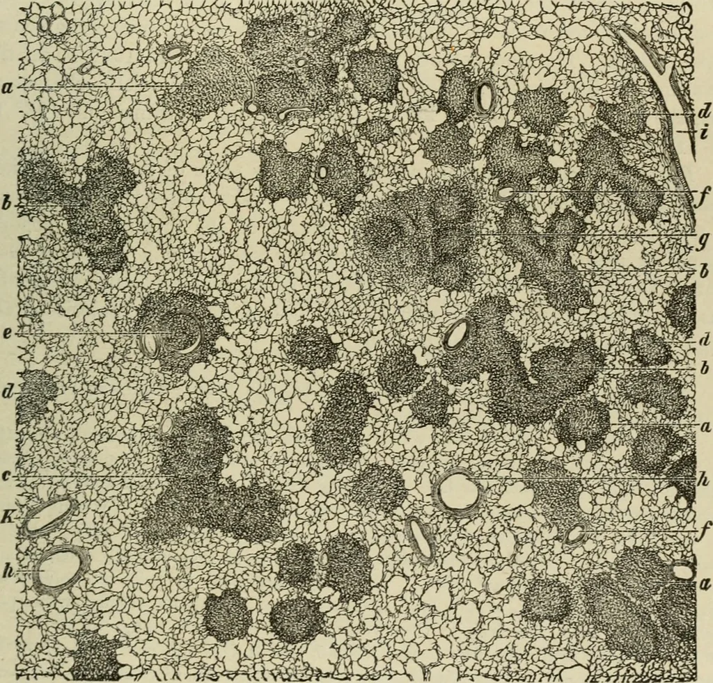 An illustration from Diseases of infancy and childhood, their dietetic, hygienic, and medical treatment : a text-book designed for practitioners and students in medicine / By Louis Fischer., 1910, leaf 599