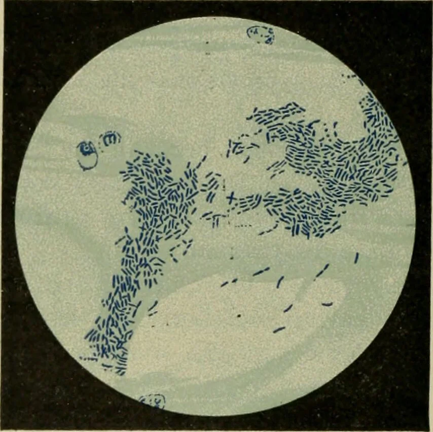An illustration from Diseases of infancy and childhood, their dietetic, hygienic, and medical treatment : a text-book designed for practitioners and students in medicine / By Louis Fischer., 1910, leaf 606