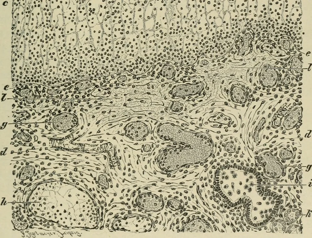 An illustration from Diseases of infancy and childhood, their dietetic, hygienic, and medical treatment : a text-book designed for practitioners and students in medicine / By Louis Fischer., 1910, leaf 609