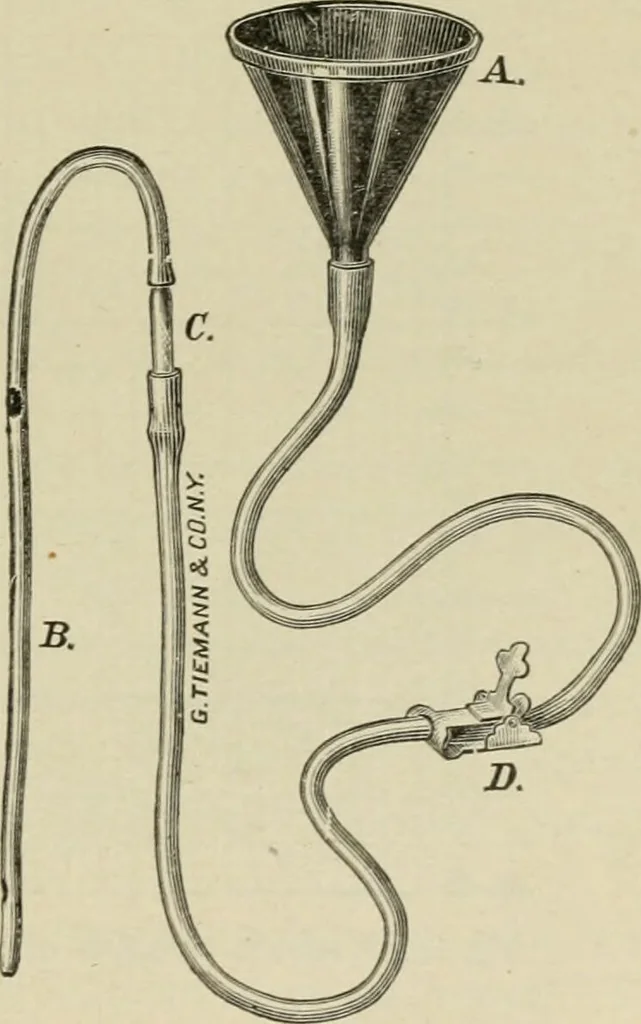 An illustration from Diseases of infancy and childhood, their dietetic, hygienic, and medical treatment : a text-book designed for practitioners and students in medicine / By Louis Fischer., 1910, leaf 63