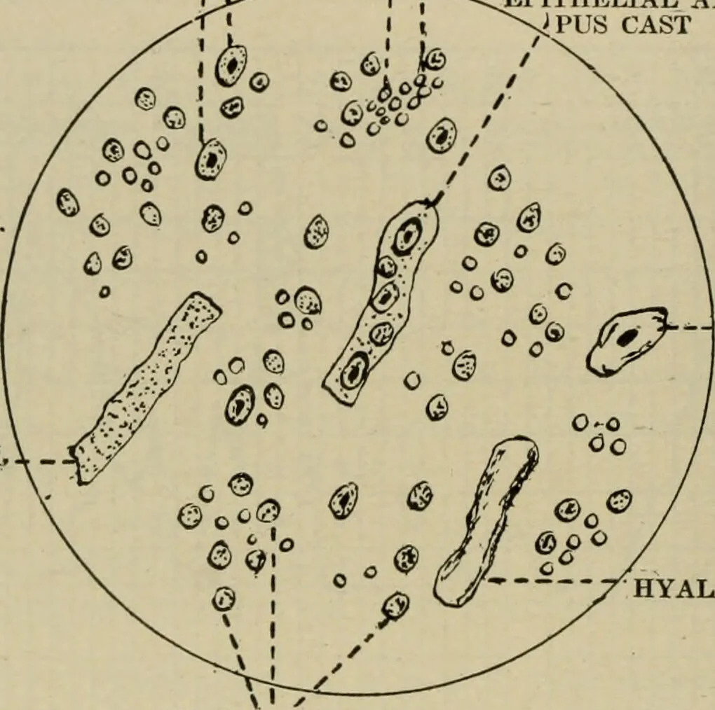 An illustration from Diseases of infancy and childhood, their dietetic, hygienic, and medical treatment : a text-book designed for practitioners and students in medicine / By Louis Fischer., 1910, leaf 728