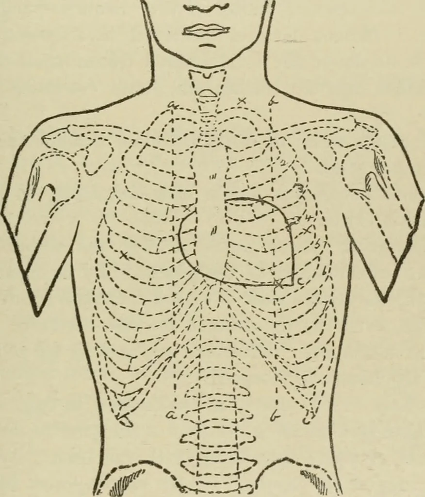 An illustration from Diseases of infancy and childhood, their dietetic, hygienic, and medical treatment : a text-book designed for practitioners and students in medicine / By Louis Fischer., 1910, leaf 729