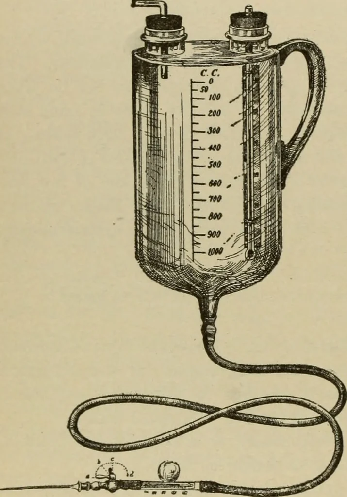 An illustration from Diseases of infancy and childhood, their dietetic, hygienic, and medical treatment : a text-book designed for practitioners and students in medicine / By Louis Fischer., 1910, leaf 736