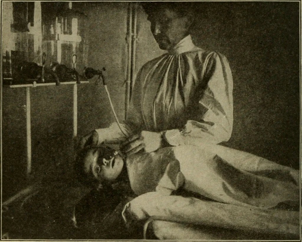 An illustration from Diseases of infancy and childhood, their dietetic, hygienic, and medical treatment : a text-book designed for practitioners and students in medicine / By Louis Fischer., 1910, leaf 740
