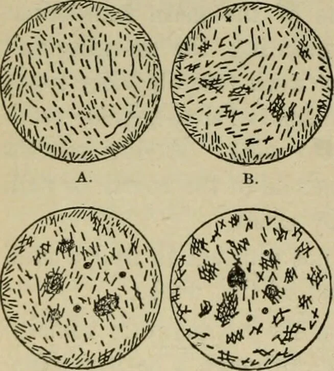 An illustration from Diseases of infancy and childhood, their dietetic, hygienic, and medical treatment : a text-book designed for practitioners and students in medicine / By Louis Fischer., 1910, leaf 766