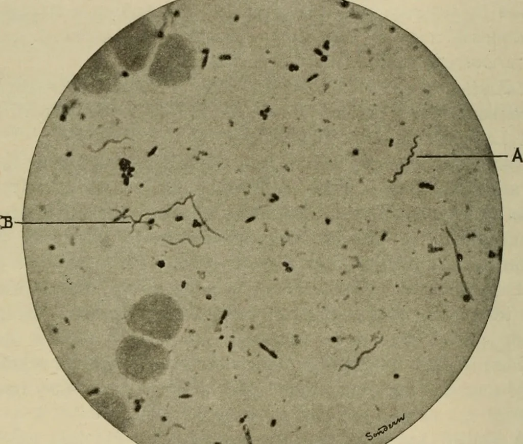 An illustration from Diseases of infancy and childhood, their dietetic, hygienic, and medical treatment : a text-book designed for practitioners and students in medicine / By Louis Fischer., 1910, leaf 790