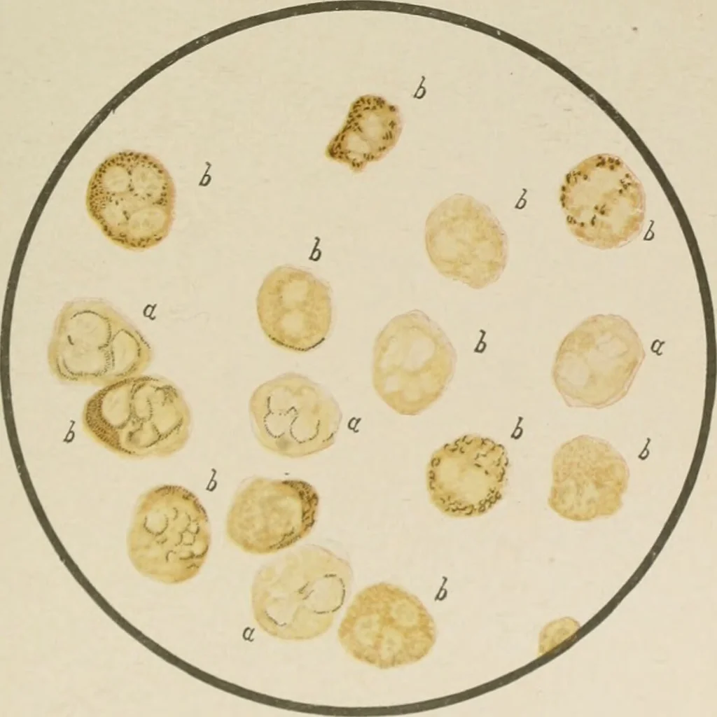 An illustration from Diseases of infancy and childhood, their dietetic, hygienic, and medical treatment : a text-book designed for practitioners and students in medicine / By Louis Fischer., 1910, leaf 803