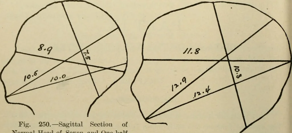 An illustration from Diseases of infancy and childhood, their dietetic, hygienic, and medical treatment : a text-book designed for practitioners and students in medicine / By Louis Fischer., 1910, leaf 854