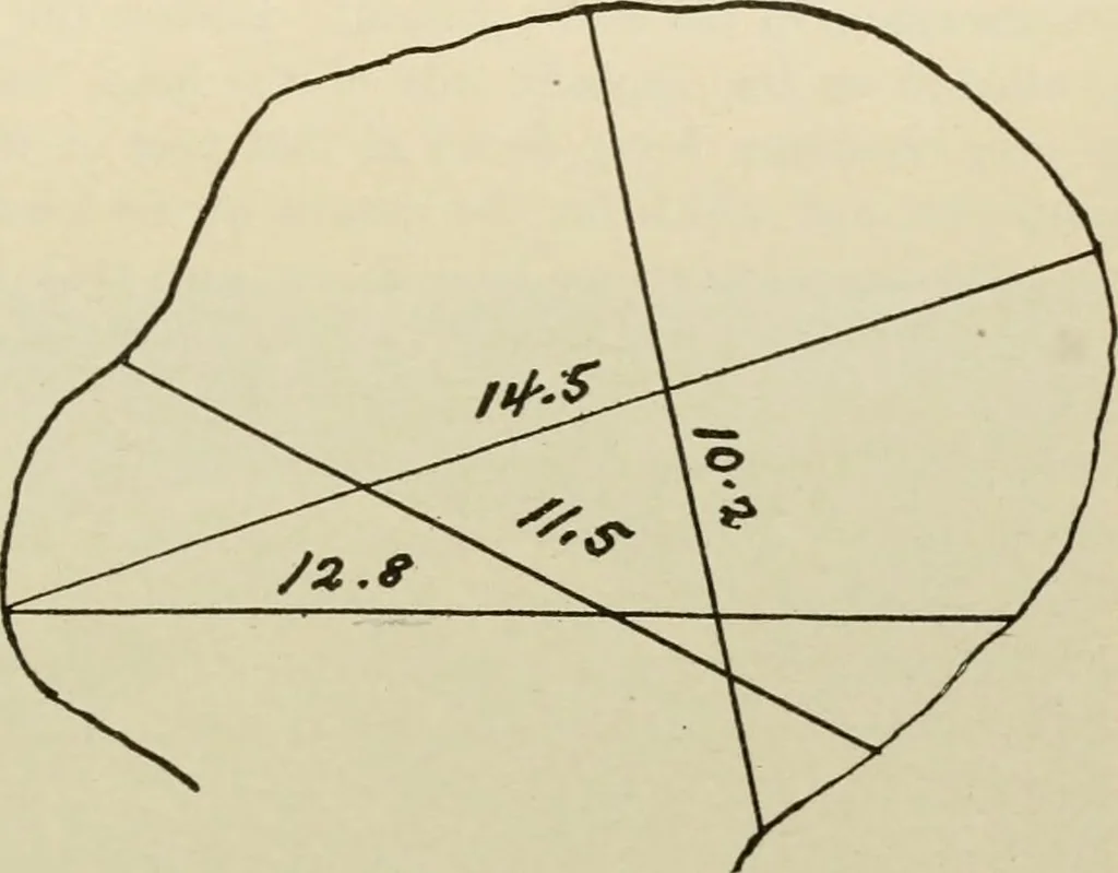 An illustration from Diseases of infancy and childhood, their dietetic, hygienic, and medical treatment : a text-book designed for practitioners and students in medicine / By Louis Fischer., 1910, leaf 855