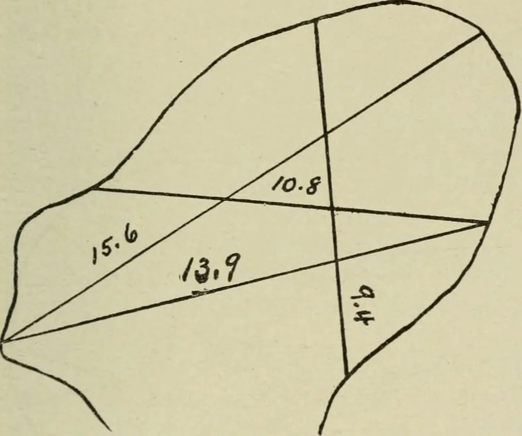 An illustration from Diseases of infancy and childhood, their dietetic, hygienic, and medical treatment : a text-book designed for practitioners and students in medicine / By Louis Fischer., 1910, leaf 855