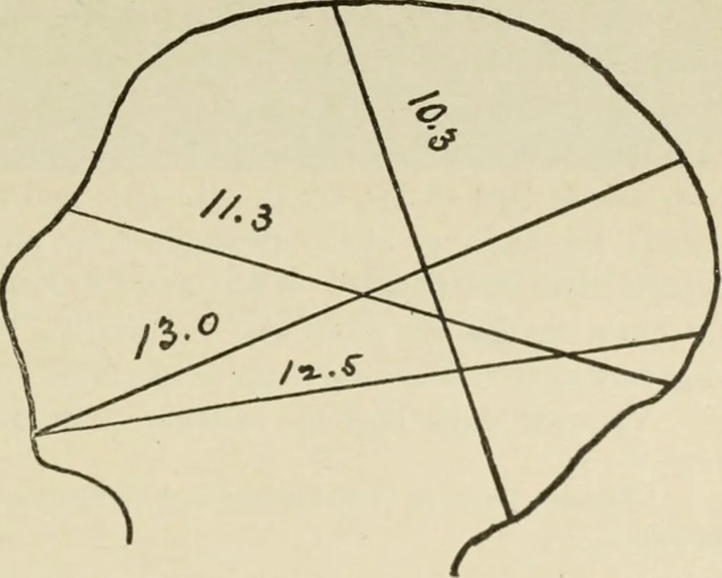 An illustration from Diseases of infancy and childhood, their dietetic, hygienic, and medical treatment : a text-book designed for practitioners and students in medicine / By Louis Fischer., 1910, leaf 855