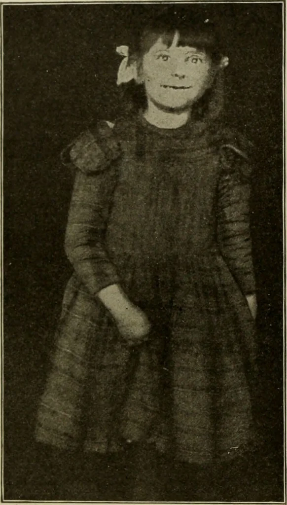 An illustration from Diseases of infancy and childhood, their dietetic, hygienic, and medical treatment : a text-book designed for practitioners and students in medicine / By Louis Fischer., 1910, leaf 934