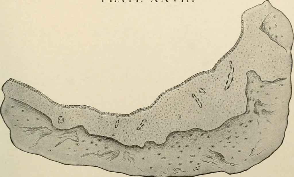 An illustration from Diseases of infancy and childhood, their dietetic, hygienic, and medical treatment : a text-book designed for practitioners and students in medicine / By Louis Fischer., 1910, leaf 943