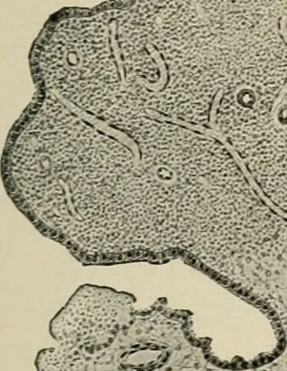 An illustration from Diseases of infancy and childhood, their dietetic, hygienic, and medical treatment : a text-book designed for practitioners and students in medicine / By Louis Fischer., 1910, leaf 943