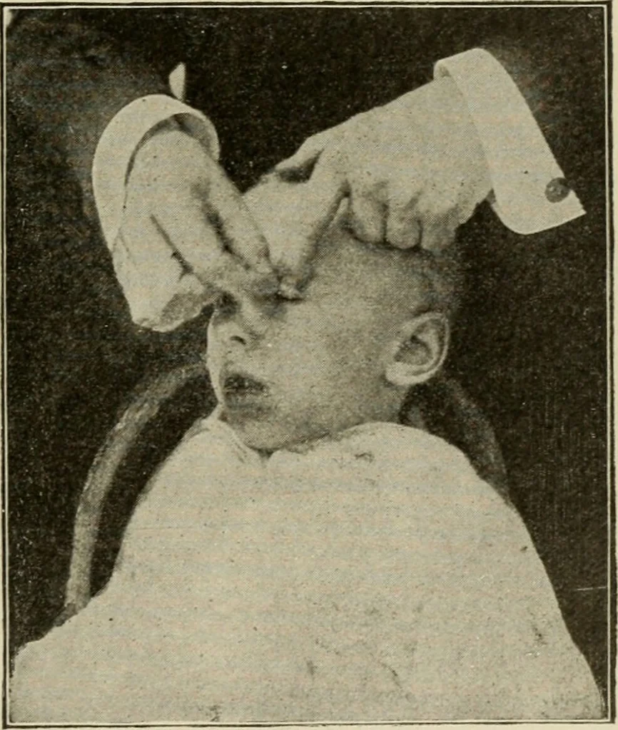 An illustration from Diseases of infancy and childhood, their dietetic, hygienic, and medical treatment : a text-book designed for practitioners and students in medicine / By Louis Fischer., 1910, leaf 957
