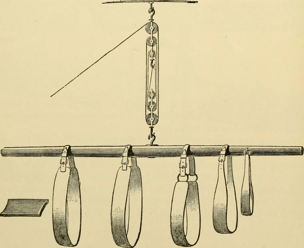 An illustration from Surgical technic; a text-book on operative surgery / by Fr. von Esmarch ... and E. Kowalzig ... translated by Professor Ludwig H. Grau ... and Willam N. Sullivan ... edited by Nicholas Senn ... With fourteen hundred and ninety-seven illustrations and fifteen colored plates., 1901, leaf 100