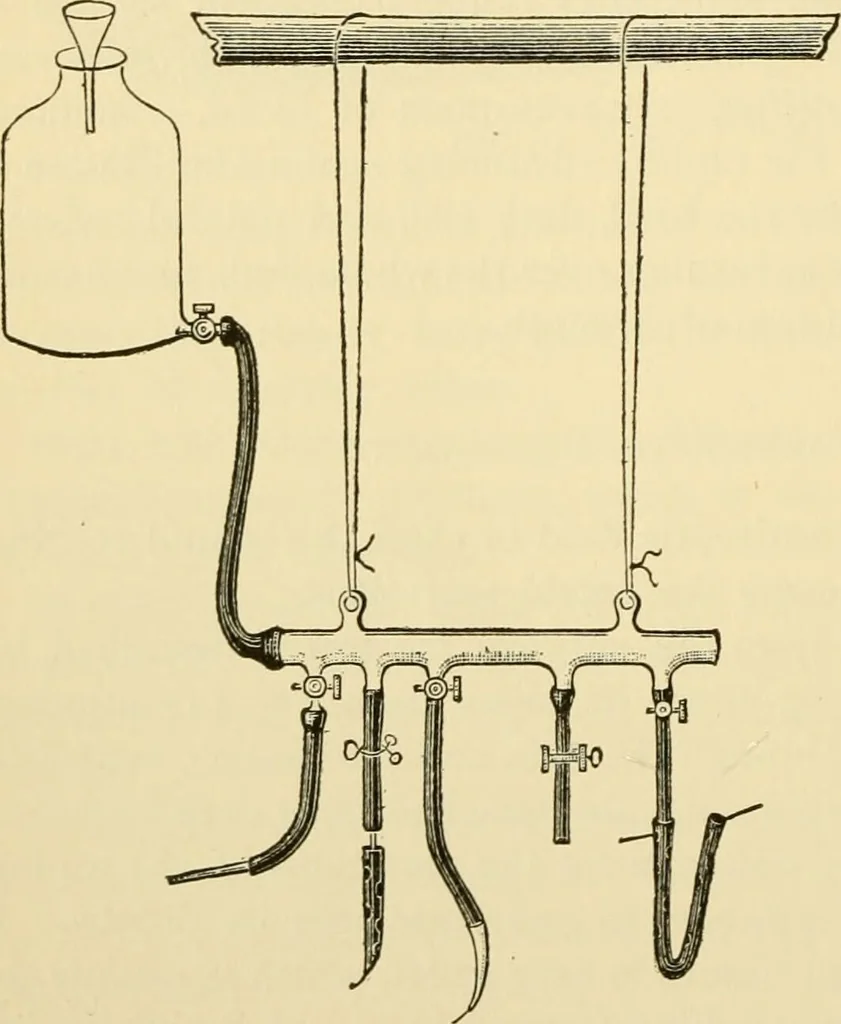 An illustration from Surgical technic; a text-book on operative surgery / by Fr. von Esmarch ... and E. Kowalzig ... translated by Professor Ludwig H. Grau ... and Willam N. Sullivan ... edited by Nicholas Senn ... With fourteen hundred and ninety-seven illustrations and fifteen colored plates., 1901, leaf 104