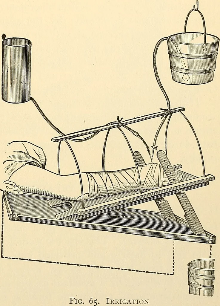 An illustration from Surgical technic; a text-book on operative surgery / by Fr. von Esmarch ... and E. Kowalzig ... translated by Professor Ludwig H. Grau ... and Willam N. Sullivan ... edited by Nicholas Senn ... With fourteen hundred and ninety-seven illustrations and fifteen colored plates., 1901, leaf 109