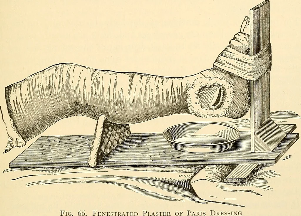 An illustration from Surgical technic; a text-book on operative surgery / by Fr. von Esmarch ... and E. Kowalzig ... translated by Professor Ludwig H. Grau ... and Willam N. Sullivan ... edited by Nicholas Senn ... With fourteen hundred and ninety-seven illustrations and fifteen colored plates., 1901, leaf 111