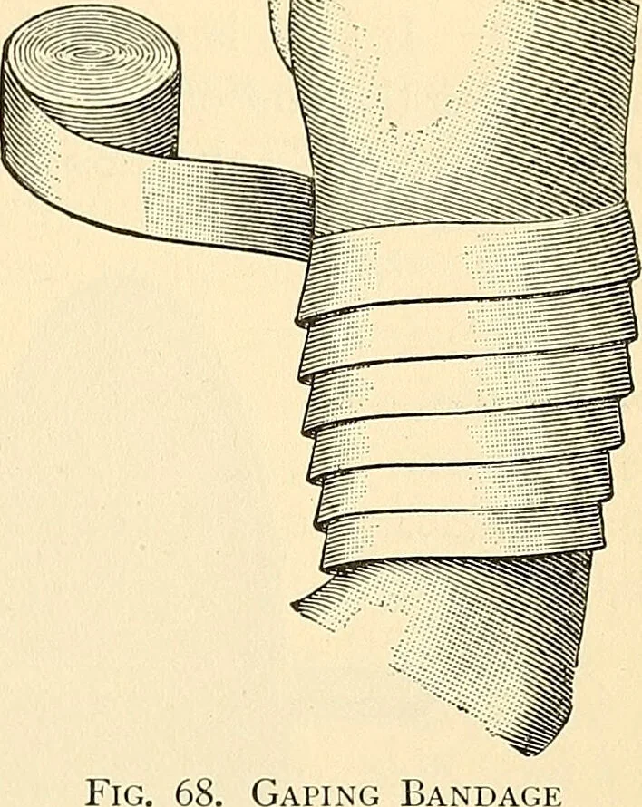 An illustration from Surgical technic; a text-book on operative surgery / by Fr. von Esmarch ... and E. Kowalzig ... translated by Professor Ludwig H. Grau ... and Willam N. Sullivan ... edited by Nicholas Senn ... With fourteen hundred and ninety-seven illustrations and fifteen colored plates., 1901, leaf 113