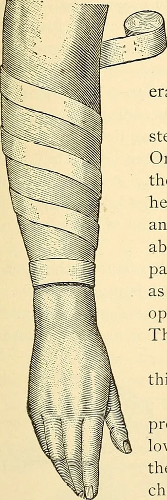 An illustration from Surgical technic; a text-book on operative surgery / by Fr. von Esmarch ... and E. Kowalzig ... translated by Professor Ludwig H. Grau ... and Willam N. Sullivan ... edited by Nicholas Senn ... With fourteen hundred and ninety-seven illustrations and fifteen colored plates., 1901, leaf 115