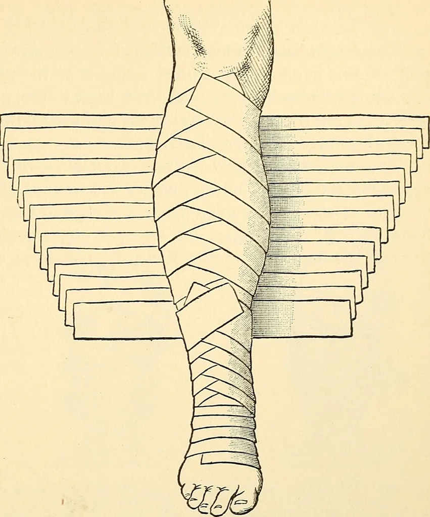 An illustration from Surgical technic; a text-book on operative surgery / by Fr. von Esmarch ... and E. Kowalzig ... translated by Professor Ludwig H. Grau ... and Willam N. Sullivan ... edited by Nicholas Senn ... With fourteen hundred and ninety-seven illustrations and fifteen colored plates., 1901, leaf 117