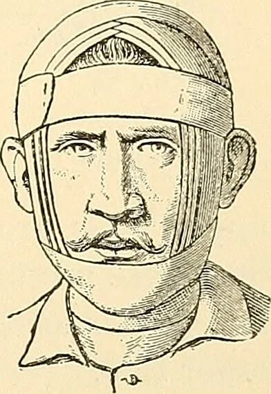 An illustration from Surgical technic; a text-book on operative surgery / by Fr. von Esmarch ... and E. Kowalzig ... translated by Professor Ludwig H. Grau ... and Willam N. Sullivan ... edited by Nicholas Senn ... With fourteen hundred and ninety-seven illustrations and fifteen colored plates., 1901, leaf 119