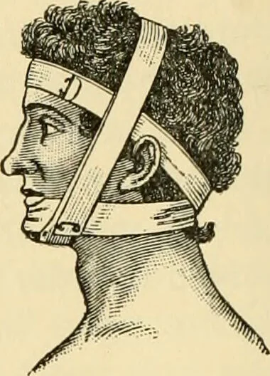 An illustration from Surgical technic; a text-book on operative surgery / by Fr. von Esmarch ... and E. Kowalzig ... translated by Professor Ludwig H. Grau ... and Willam N. Sullivan ... edited by Nicholas Senn ... With fourteen hundred and ninety-seven illustrations and fifteen colored plates., 1901, leaf 120