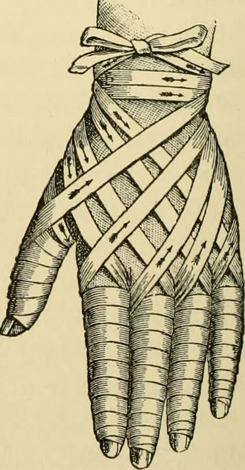 An illustration from Surgical technic; a text-book on operative surgery / by Fr. von Esmarch ... and E. Kowalzig ... translated by Professor Ludwig H. Grau ... and Willam N. Sullivan ... edited by Nicholas Senn ... With fourteen hundred and ninety-seven illustrations and fifteen colored plates., 1901, leaf 120