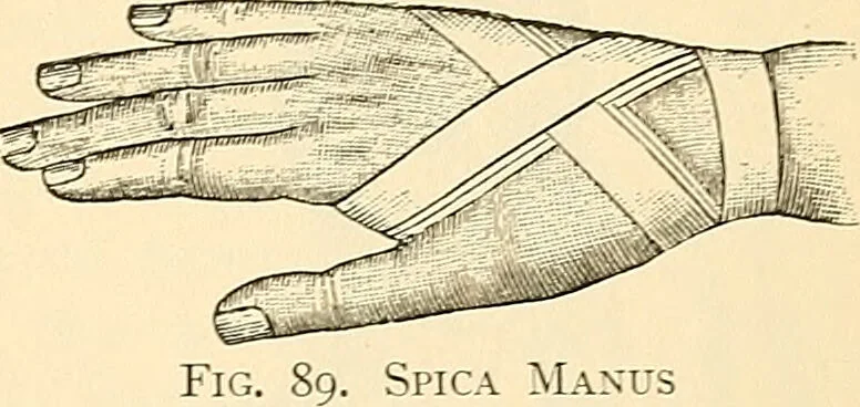 An illustration from Surgical technic; a text-book on operative surgery / by Fr. von Esmarch ... and E. Kowalzig ... translated by Professor Ludwig H. Grau ... and Willam N. Sullivan ... edited by Nicholas Senn ... With fourteen hundred and ninety-seven illustrations and fifteen colored plates., 1901, leaf 121