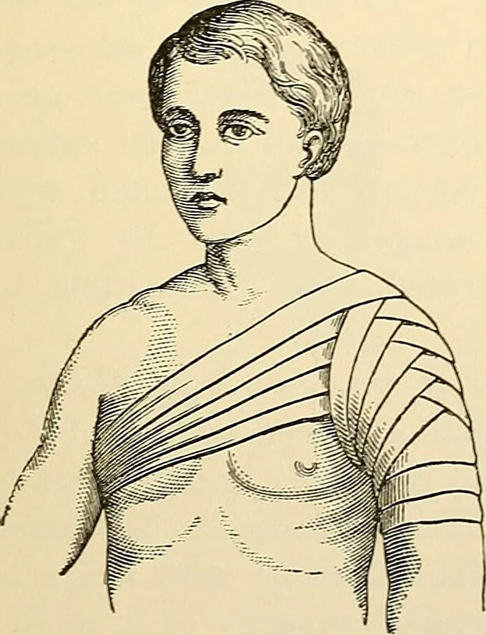 An illustration from Surgical technic; a text-book on operative surgery / by Fr. von Esmarch ... and E. Kowalzig ... translated by Professor Ludwig H. Grau ... and Willam N. Sullivan ... edited by Nicholas Senn ... With fourteen hundred and ninety-seven illustrations and fifteen colored plates., 1901, leaf 121