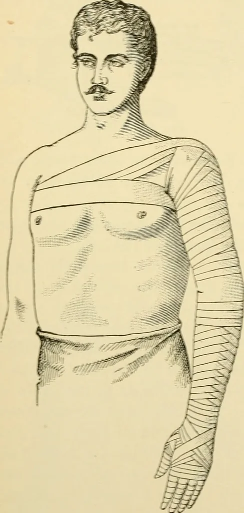 An illustration from Surgical technic; a text-book on operative surgery / by Fr. von Esmarch ... and E. Kowalzig ... translated by Professor Ludwig H. Grau ... and Willam N. Sullivan ... edited by Nicholas Senn ... With fourteen hundred and ninety-seven illustrations and fifteen colored plates., 1901, leaf 122