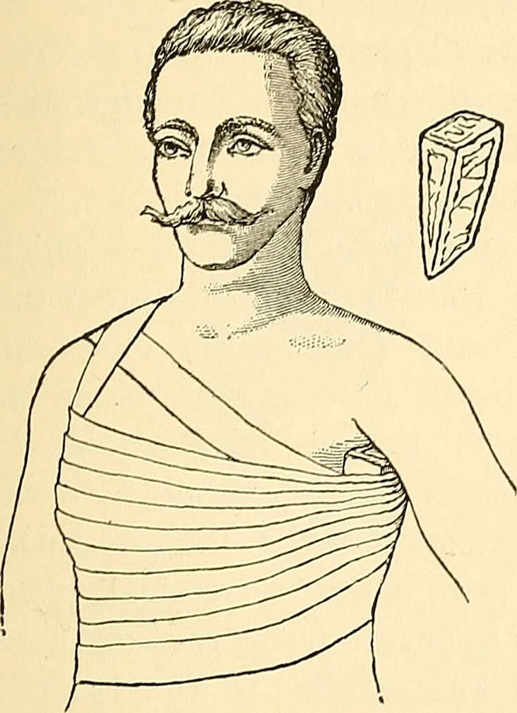An illustration from Surgical technic; a text-book on operative surgery / by Fr. von Esmarch ... and E. Kowalzig ... translated by Professor Ludwig H. Grau ... and Willam N. Sullivan ... edited by Nicholas Senn ... With fourteen hundred and ninety-seven illustrations and fifteen colored plates., 1901, leaf 123