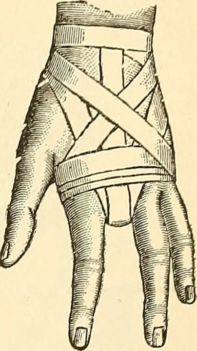An illustration from Surgical technic; a text-book on operative surgery / by Fr. von Esmarch ... and E. Kowalzig ... translated by Professor Ludwig H. Grau ... and Willam N. Sullivan ... edited by Nicholas Senn ... With fourteen hundred and ninety-seven illustrations and fifteen colored plates., 1901, leaf 123