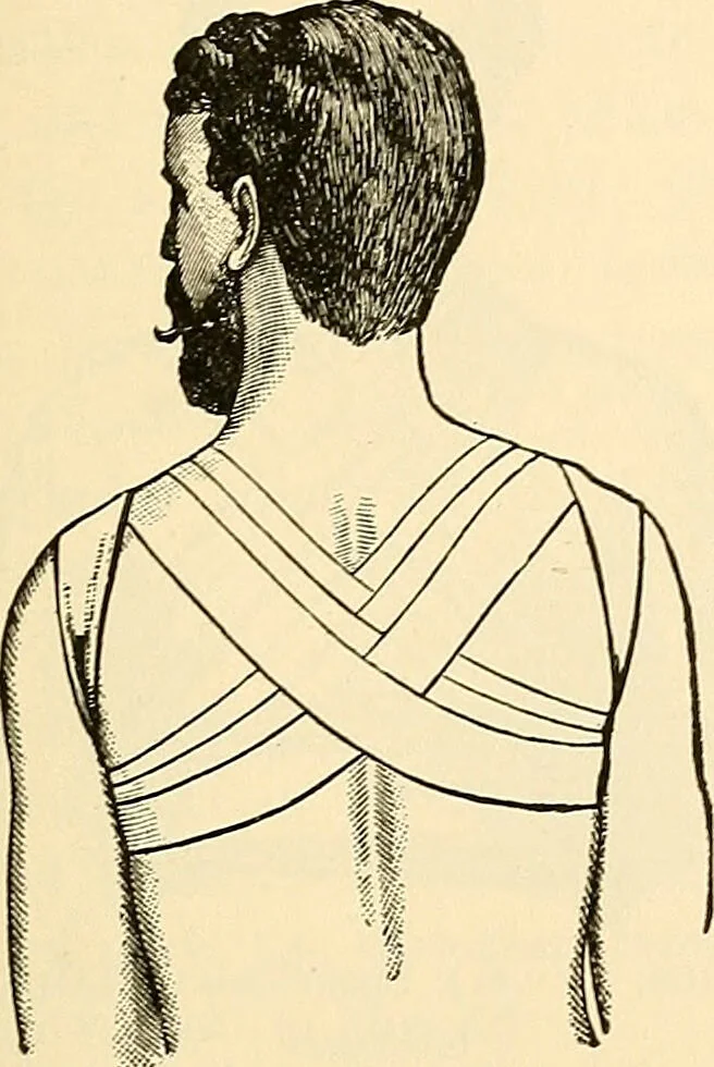 An illustration from Surgical technic; a text-book on operative surgery / by Fr. von Esmarch ... and E. Kowalzig ... translated by Professor Ludwig H. Grau ... and Willam N. Sullivan ... edited by Nicholas Senn ... With fourteen hundred and ninety-seven illustrations and fifteen colored plates., 1901, leaf 125