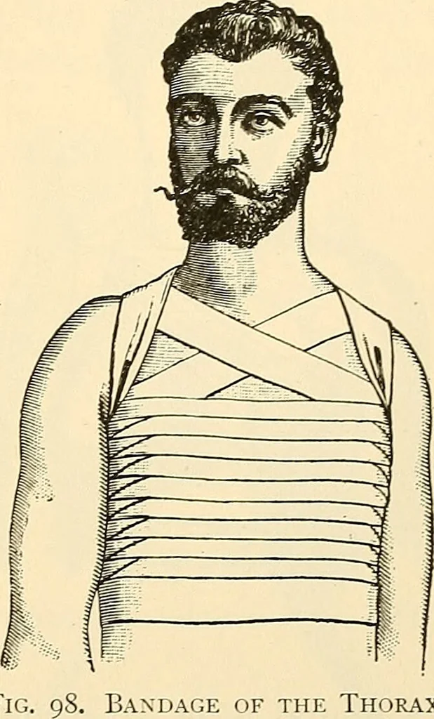 An illustration from Surgical technic; a text-book on operative surgery / by Fr. von Esmarch ... and E. Kowalzig ... translated by Professor Ludwig H. Grau ... and Willam N. Sullivan ... edited by Nicholas Senn ... With fourteen hundred and ninety-seven illustrations and fifteen colored plates., 1901, leaf 125