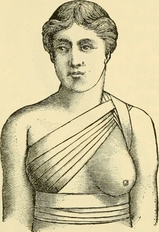 An illustration from Surgical technic; a text-book on operative surgery / by Fr. von Esmarch ... and E. Kowalzig ... translated by Professor Ludwig H. Grau ... and Willam N. Sullivan ... edited by Nicholas Senn ... With fourteen hundred and ninety-seven illustrations and fifteen colored plates., 1901, leaf 126
