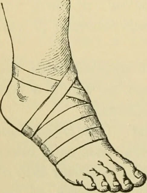 An illustration from Surgical technic; a text-book on operative surgery / by Fr. von Esmarch ... and E. Kowalzig ... translated by Professor Ludwig H. Grau ... and Willam N. Sullivan ... edited by Nicholas Senn ... With fourteen hundred and ninety-seven illustrations and fifteen colored plates., 1901, leaf 126