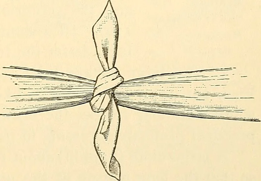 An illustration from Surgical technic; a text-book on operative surgery / by Fr. von Esmarch ... and E. Kowalzig ... translated by Professor Ludwig H. Grau ... and Willam N. Sullivan ... edited by Nicholas Senn ... With fourteen hundred and ninety-seven illustrations and fifteen colored plates., 1901, leaf 129