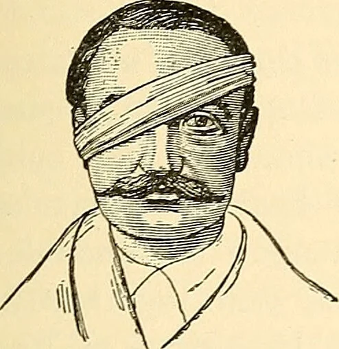 An illustration from Surgical technic; a text-book on operative surgery / by Fr. von Esmarch ... and E. Kowalzig ... translated by Professor Ludwig H. Grau ... and Willam N. Sullivan ... edited by Nicholas Senn ... With fourteen hundred and ninety-seven illustrations and fifteen colored plates., 1901, leaf 131